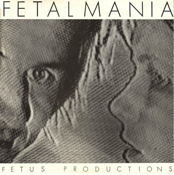 fetalmania